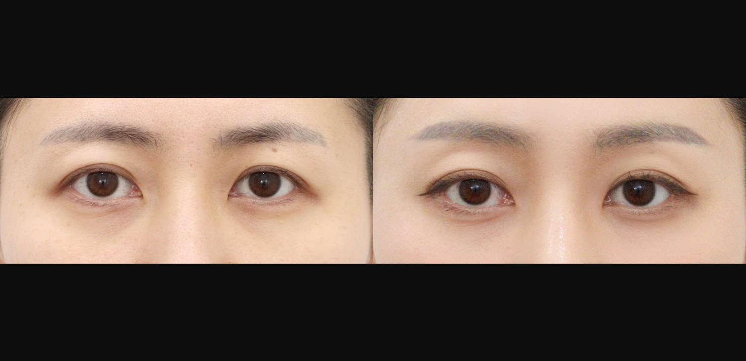 내시경 이마거상